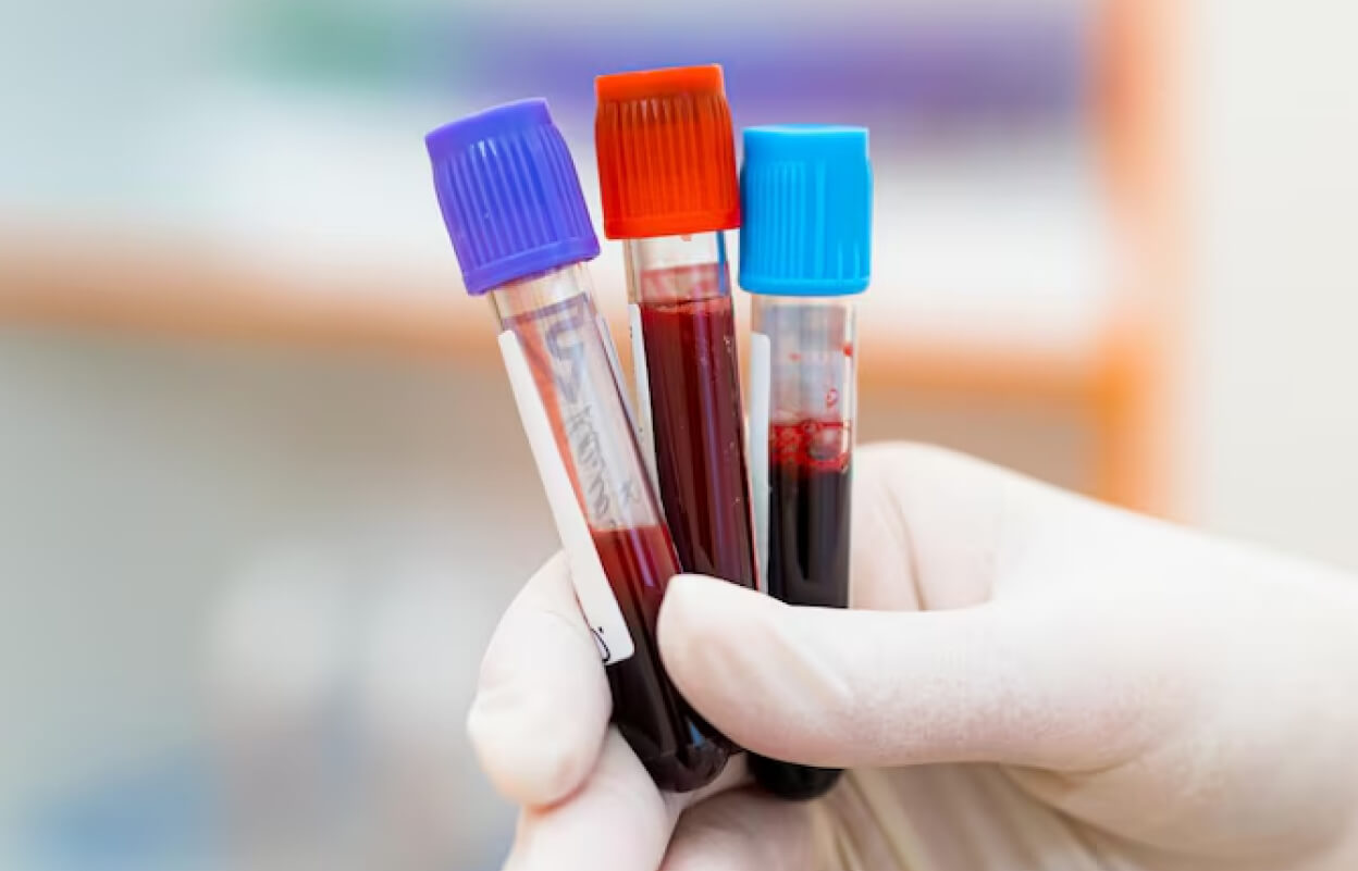 лабораторный кадр с пробирками крови